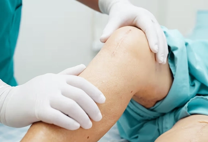 Benefits of Knee Replacement Surgery for Senior Citizens